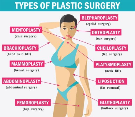 انواع جراحی پلاستیک