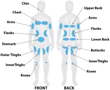 Body Sculpting - پیکرتراشی بدن
