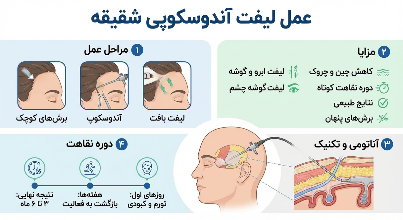 لیفت شقیقه اندوسکوپیک