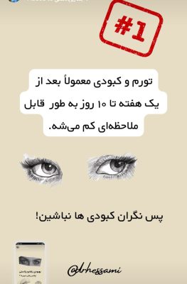 روند کلی جراحی پلک بالا