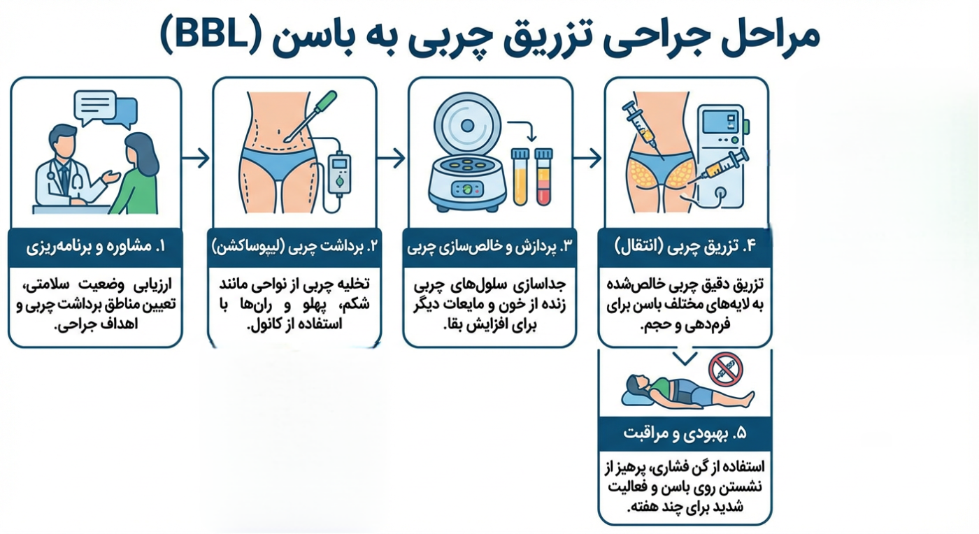 تزریق چربی به باسن