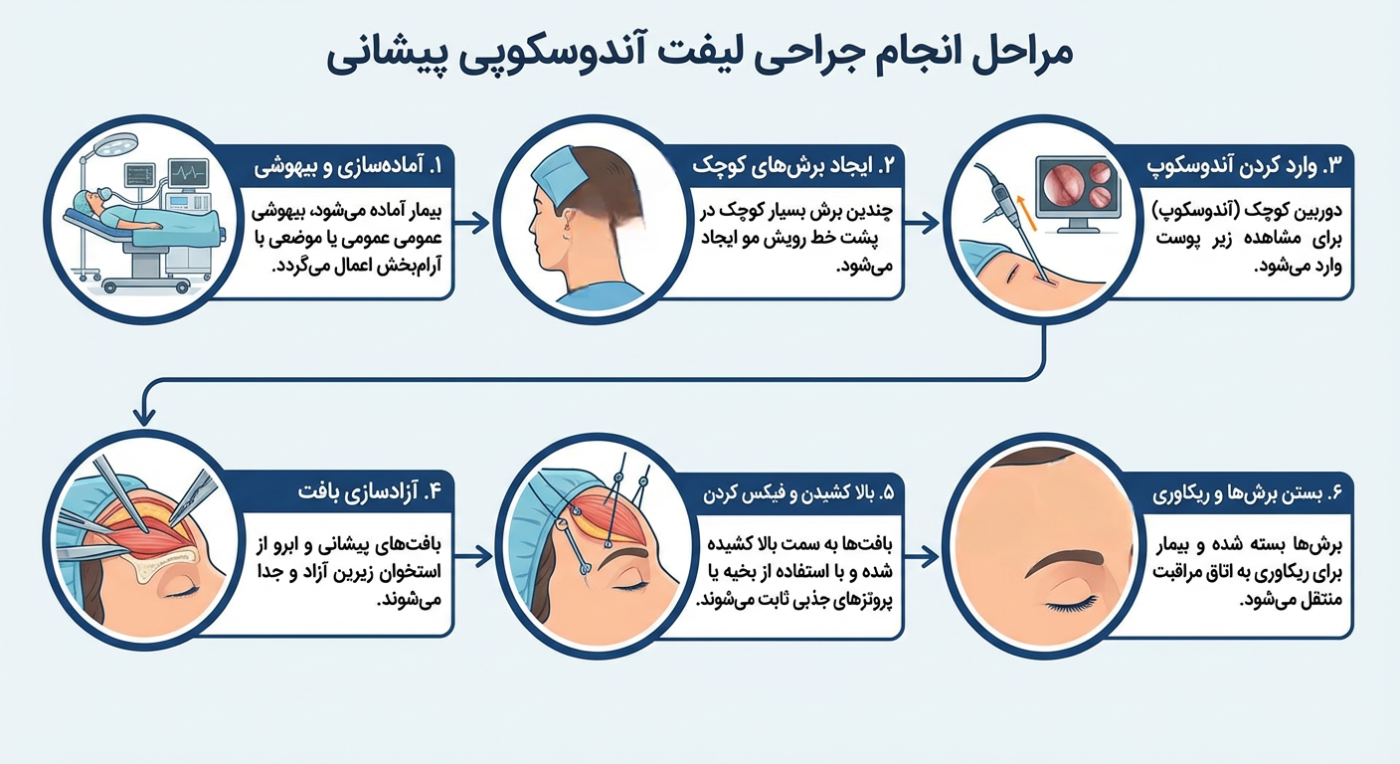 قیمت لیفت ابرو