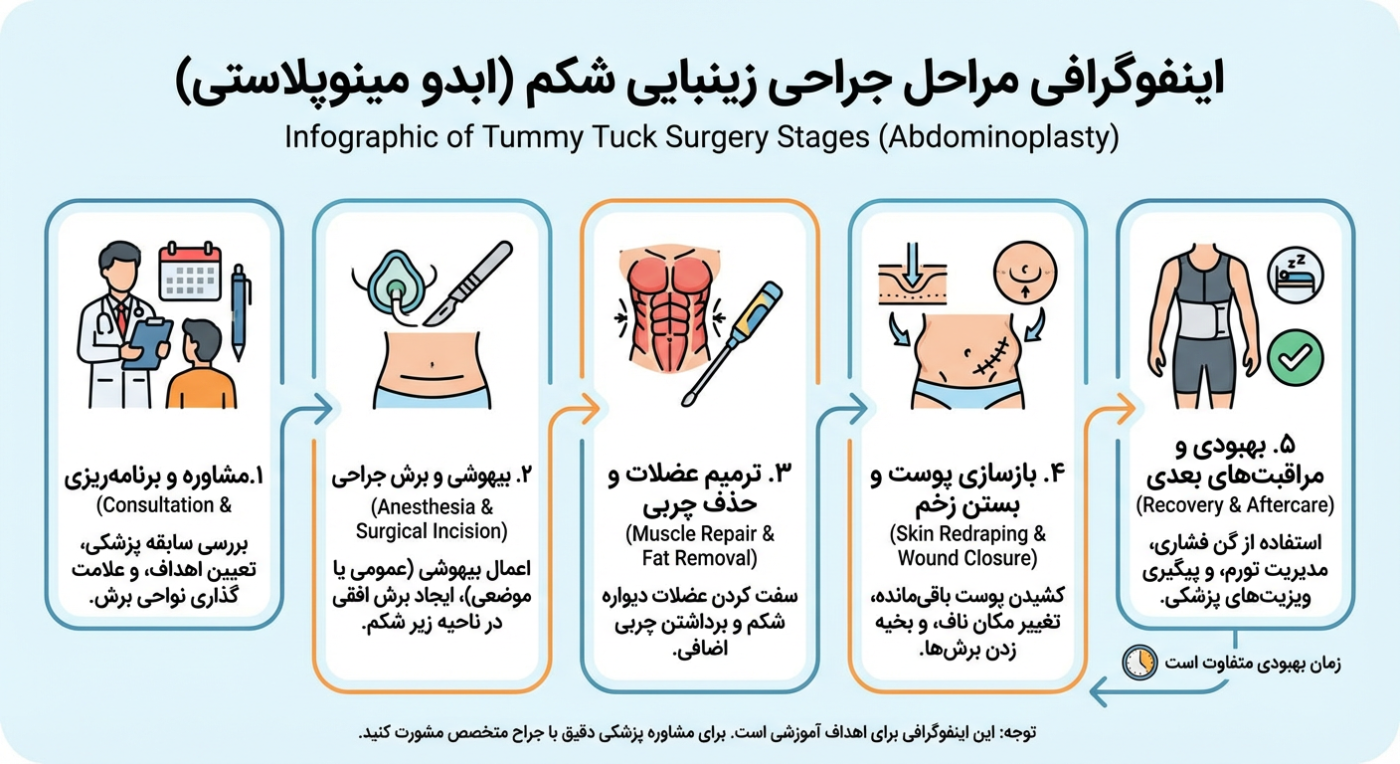 عمل زیبایی شکم