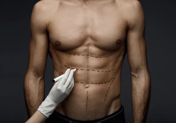 عمل زیبایی شکم