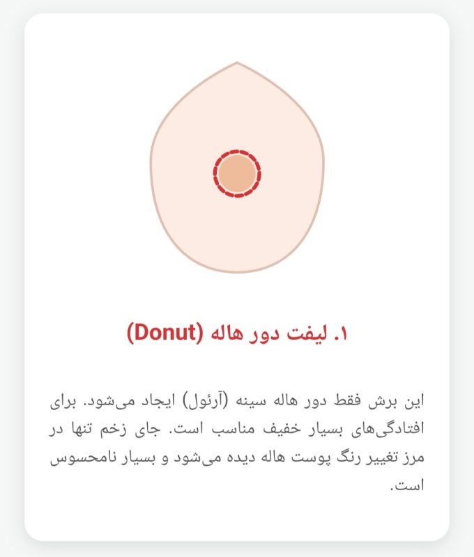 عمل لیفت سینه