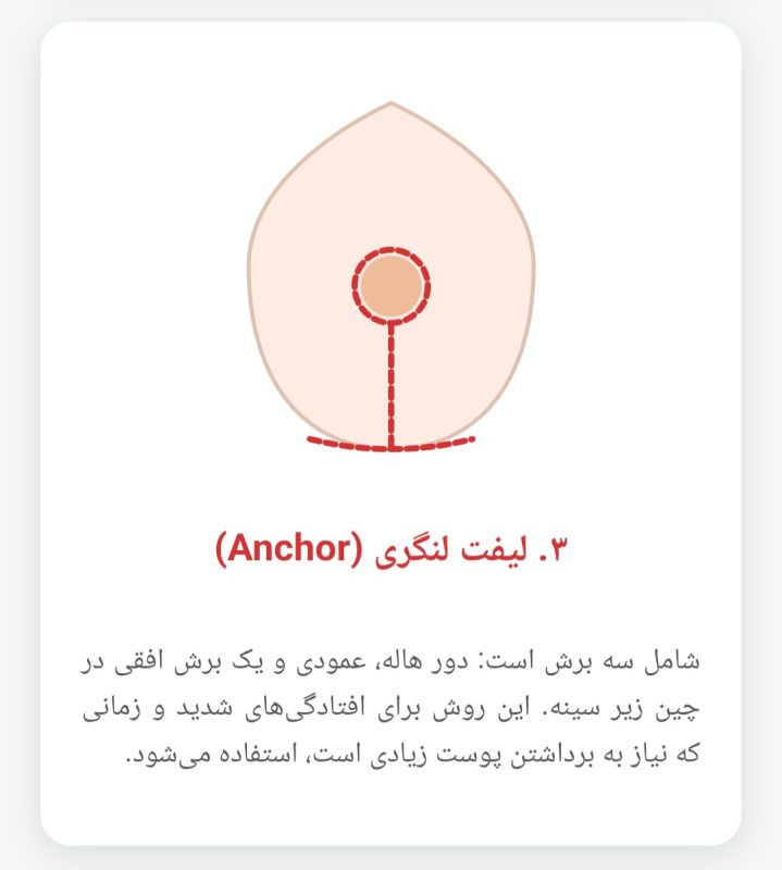 عمل لیفت سینه