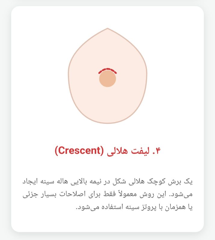 عمل لیفت سینه