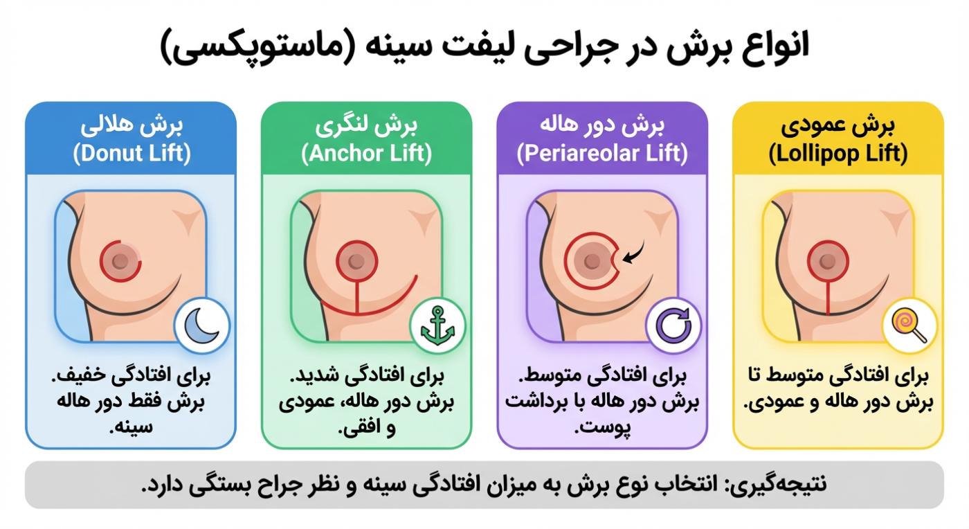 عمل لیفت سینه