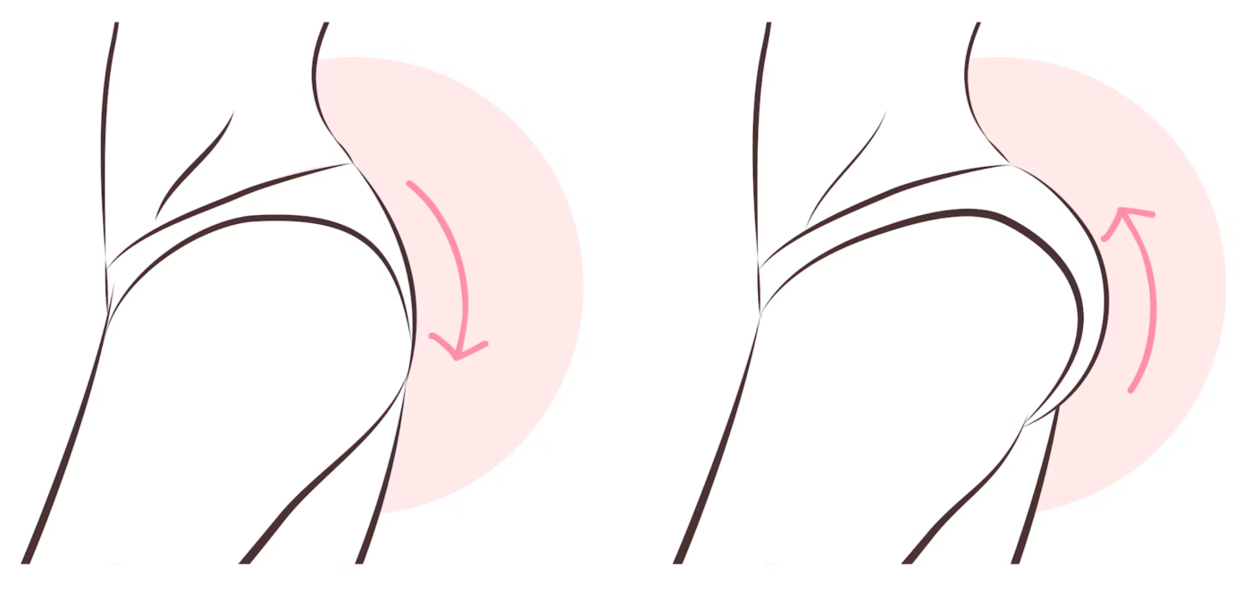 عمل بزرگ کردن باسن