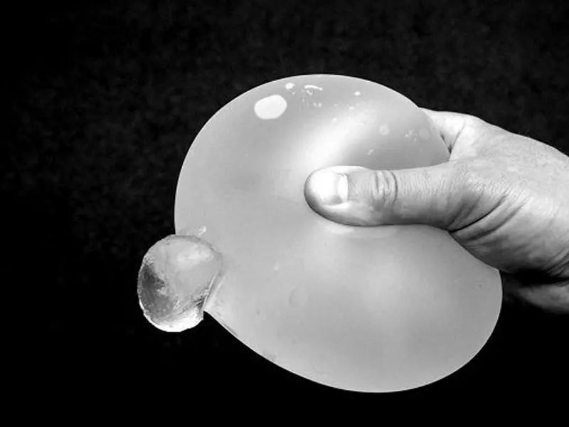 جراحی خارج کردن پروتز سینه