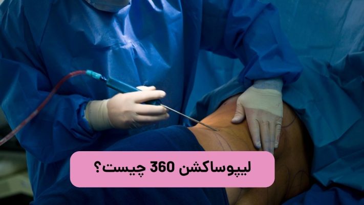 هزینه عمل لیپوساکشن 360 درجه